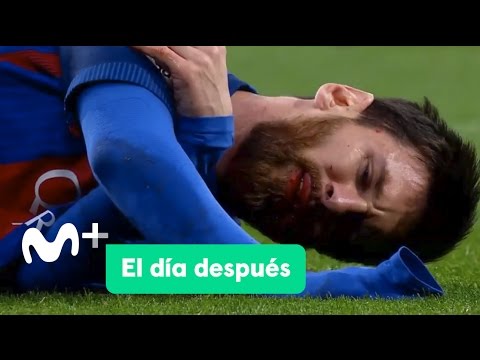 El Día Después (24/04/2017): El Clásico de Messi